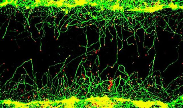 タンパク質間相互作用を安定化する天然分子が軸索再生を刺激。脊髄損傷や卒中の標的候補になり得るか？
