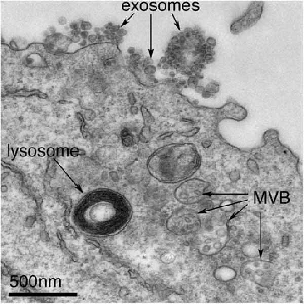 移植幹細胞由来エクソソームは心臓発作からの回復を助ける。移植細胞からの循環エキソソーム解析（液体生検）は医師が回復の程度を把握することを可能にする。