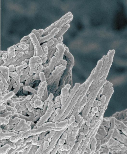 既存のニキビ薬（ミノサイクリン）が動脈硬化の予防・治療に非常に有効であることが判明