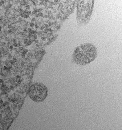 エキソソーム由来MicroRNAが多発性硬化症のパワフルなバイオマーカーになり得るとの新研究