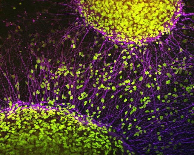 新技術で脳細胞の老化を追跡：脳の老化プロセスを理解する新たな手段