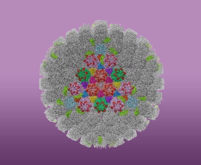 遺伝子治療が膠芽腫に有効：再発グリオブラストーマ患者の生存延長を示す