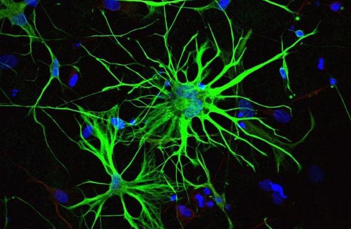アルツハイマー病の発症の個人差に迫る─ピッツバーグ大学の研究者がアストロサイトの役割を明らかに