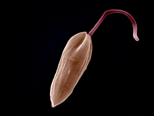 なぜリーシュマニア症は痛みを伴わないのか？寄生虫疾患の痛みの知覚に関する新発見