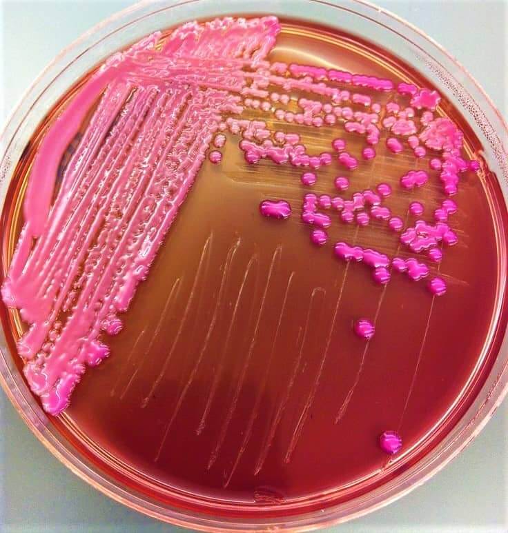 抗生物質が効かない感染症に新たな光！牛由来ペプチドの可能性