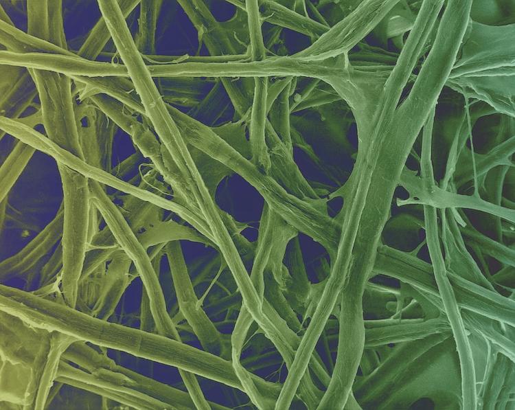腸の健康に革命を起こす ヒト腸内におけるセルロース分解細菌の驚くべき発見