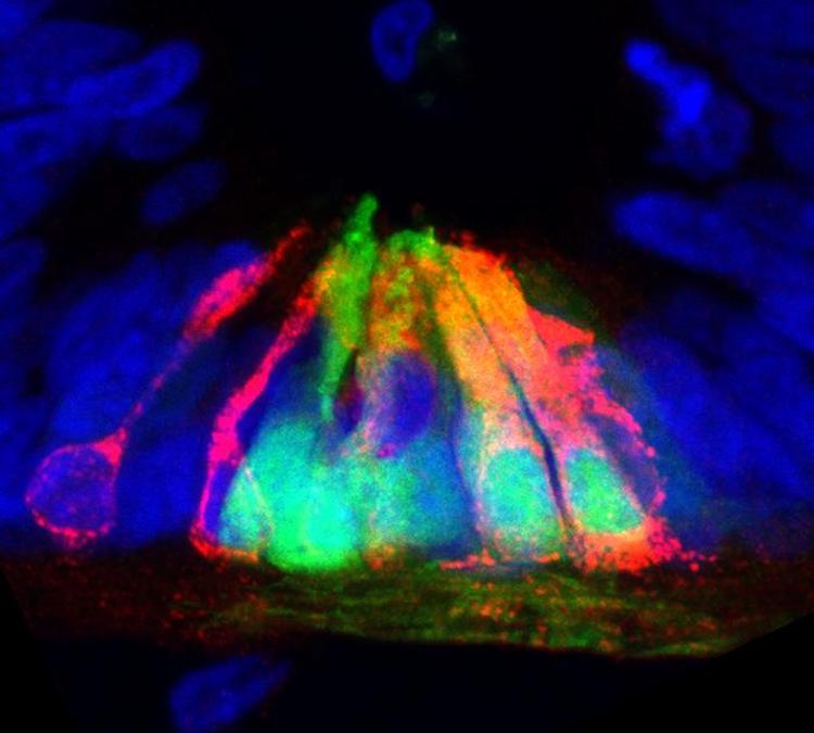 Netrin1が脊髄発生を制御？新発見が神経修復の可能性を示唆