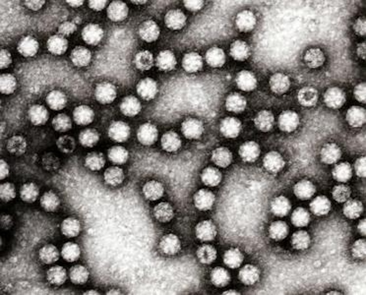 ヒトアストロウイルスの侵入メカニズムを解明！ワクチン開発に光