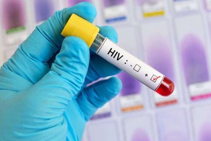 HIV感染を防ぐ鍵？VNPが示す免疫メカニズムの新発見