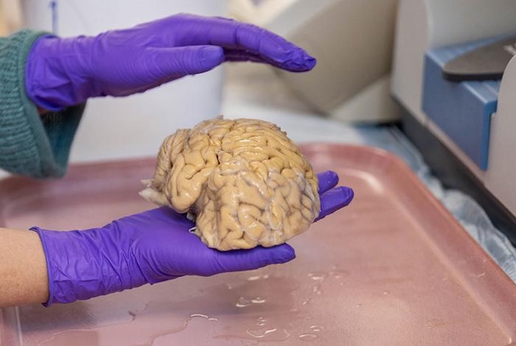 驚異の記憶力を持つ高齢者「スーパーエイジャー」の脳は、何が違うのか？