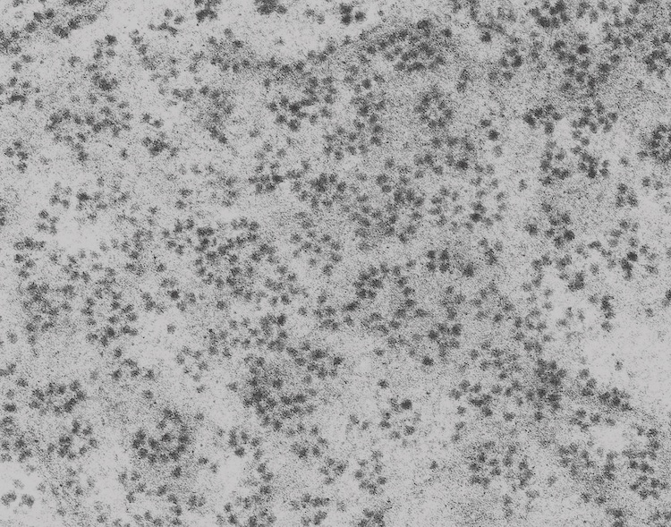脳の発達過程に潜む「静かな期間」。リボソーム減少が神経発達障害の原因となる仕組みを解明